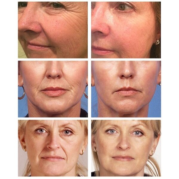 Collagen Wrinkle Removal Cream Fade Fine Lines Firming Lifting Anti-aging Improve Puffiness Moisturizing Tighten Beauty Care - Image 2