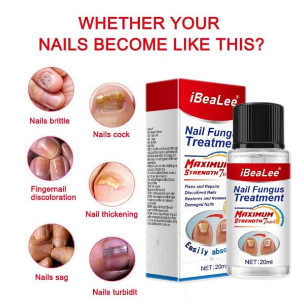 For Nail Fungal Treatment Feet Care Essence Extra Strong Nails Repair Foot Toe Nail Fungus Removal Gel Beauty Health Care - Image 5