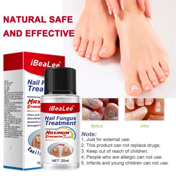 For Nail Fungal Treatment Feet Care Essence Extra Strong Nails Repair Foot Toe Nail Fungus Removal Gel Beauty Health Care - Image 7