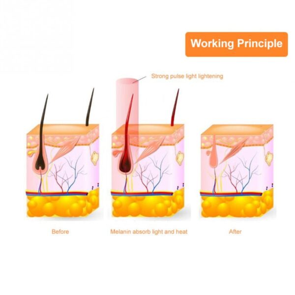 IPL Device Hair Removal Epilator for Women 500000 Flashes Epilator Hair Remover Shaving Machine Facial Epilator Women's Shaver - Image 5