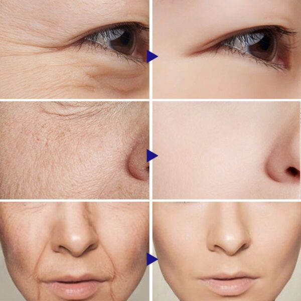 Instant Remove Wrinkle Cream Retinol Anti-Aging Fade Fine Lines Reduce Wrinkles Lifting Firming Cream Face Skin Care Products - Image 2