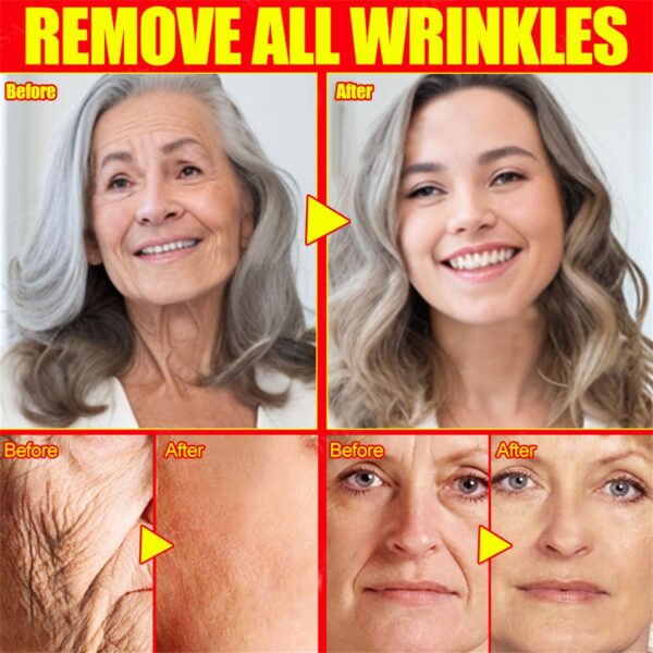 Instant Wrinkle Remove Serum Retinol Lifting Firming Anti Aging Essence Fade Fine Lines Whitening Face Skin Care Korea Cosmetic - Image 3