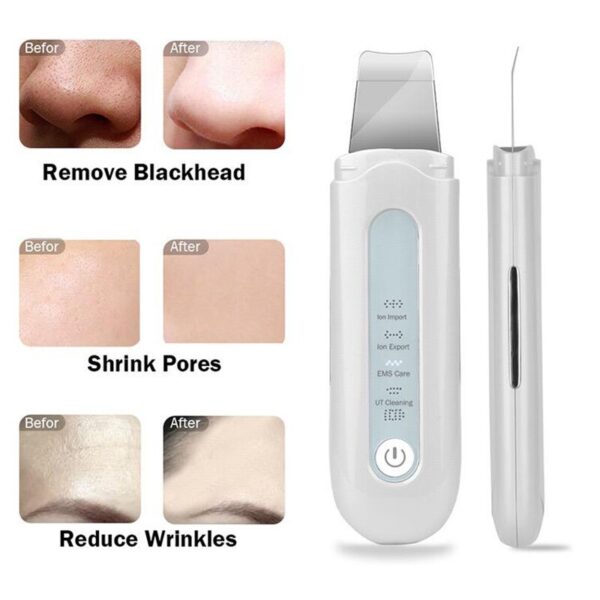 New Beauty Professional Face Beauty Personal Care Device Ultrasonic Facial Lift Sonic Face Cleaning Skin Scrubber Spatula - Image 6