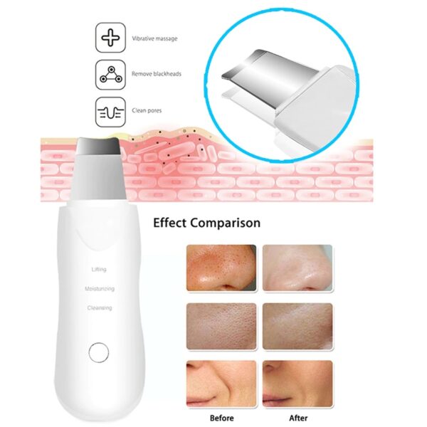 Ultrasonic Skin Scrubber Beauty Personal Care Device Deep Cleansing Therapy Ultrasonic Facial Skin Scrubber - Image 3